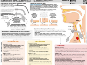 ¿Qué es una traqueostomía?