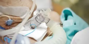 Cuidados Esenciales al Paciente Traqueostomizado