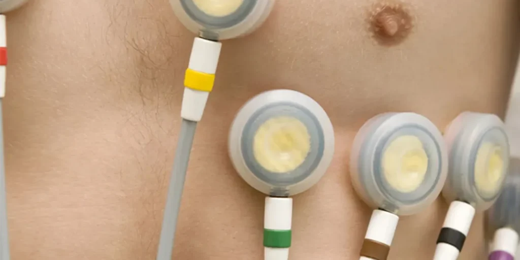 Electrocardiografía